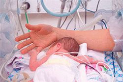 Катетеризация сердца у недоношенного ребёнка